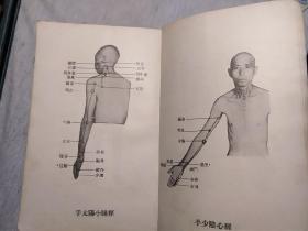 针灸易学新法