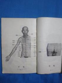 针灸易学新涛