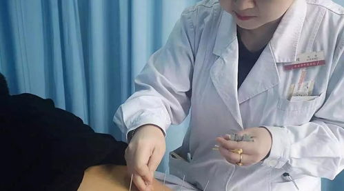 世界针灸日 让绿色疗法服务更多人