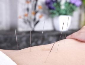 奇氏阴阳针灸无痛减肥疗法 面部微雕与体雕的专业培训解析