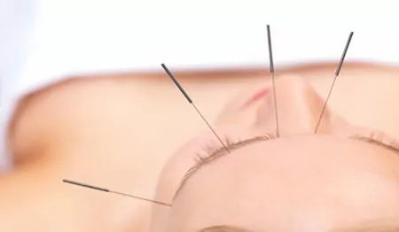 针灸减肥会反弹吗？如何科学避免反弹